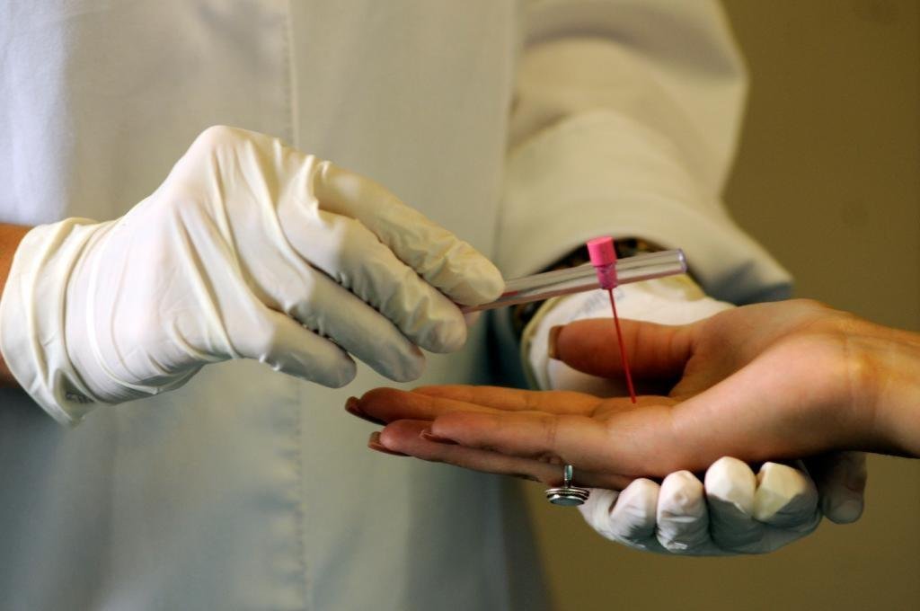 Hanseníase Mato Grosso: SES-MT reforça ações de combate