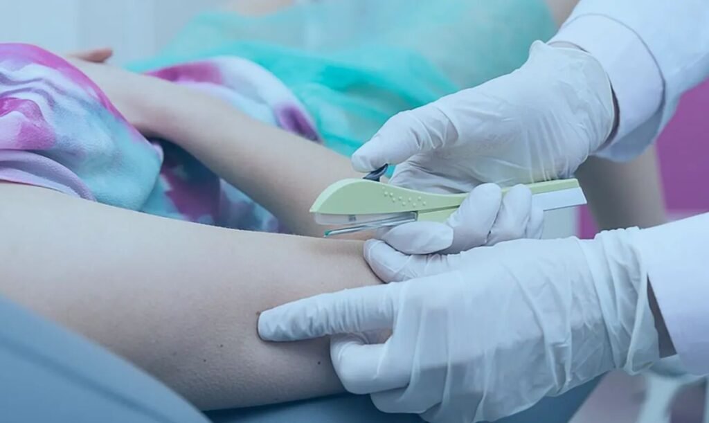 Implanon em Cáceres: Prefeitura amplia método contraceptivo