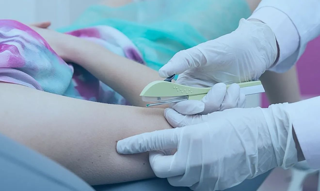 Implanon em Cáceres: Prefeitura amplia método contraceptivo