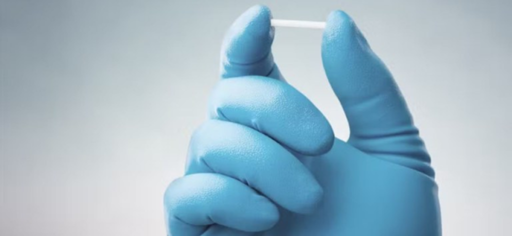 Implante contraceptivo Implanon: como funciona e acesso