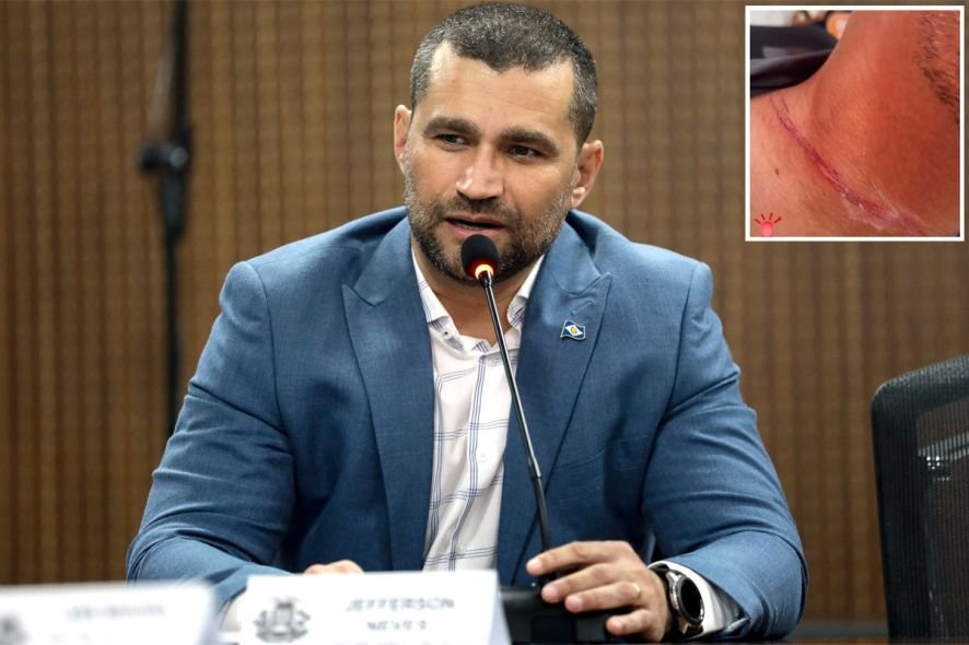 Secretário ferido por fio em Cuiabá alerta motociclistas