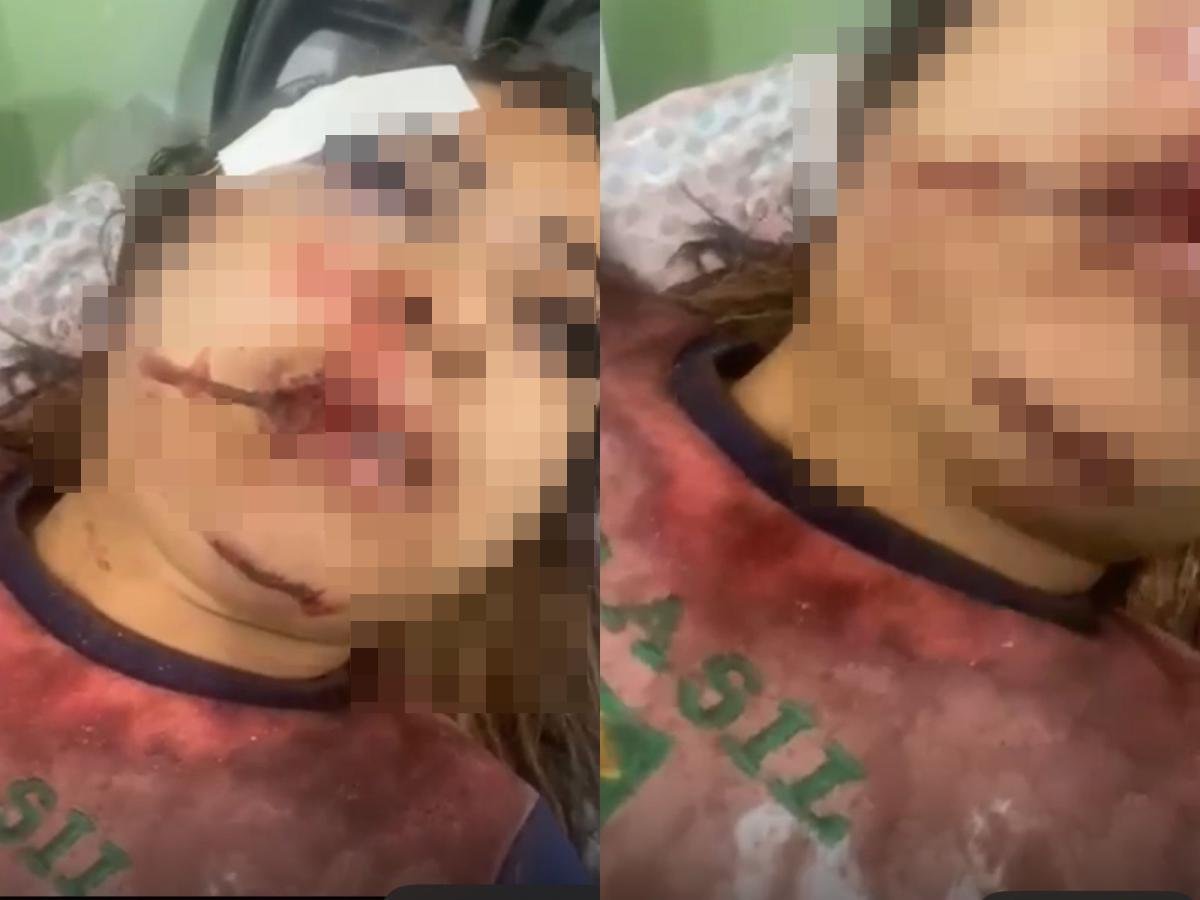 Agressão de garota de programa: Jovem é agredida em VG