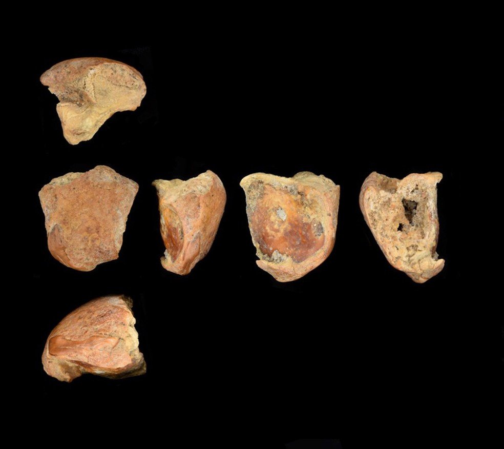 Incisivo de Shanidar A partido ao meio após um trauma sofrido em vida. O desgaste indica que o neandertal sobreviveu ao ferimento.