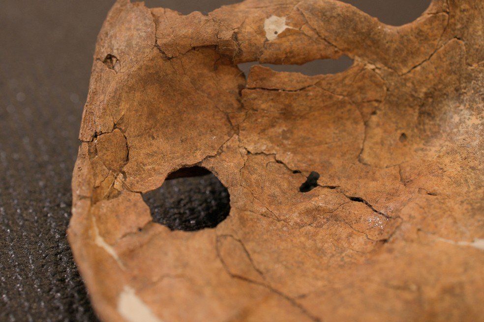 Escápula esquerda de um Neanderthal que teria morrido por causa de uma lança 75 mil anos atrás.
